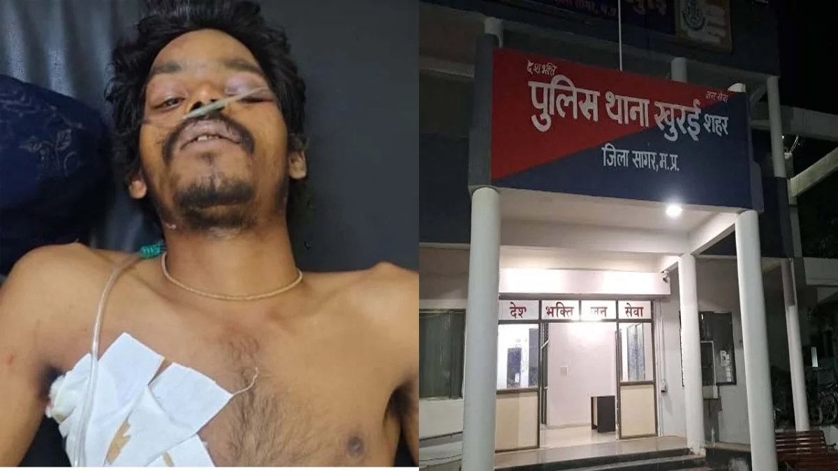चाचा ने चचेरे भाई को चाकू मारा, भतीजी के प्रेम विवाह से था नाराज